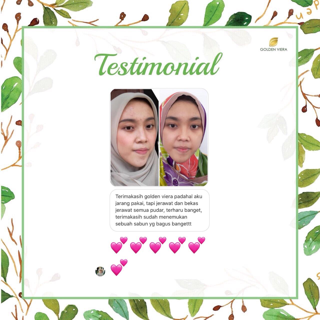 Foto testimoni N******A