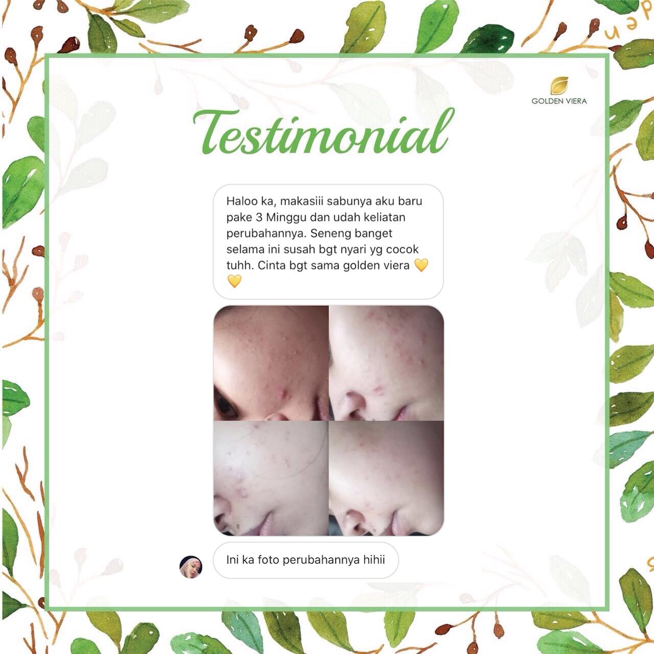 Foto testimoni M***A