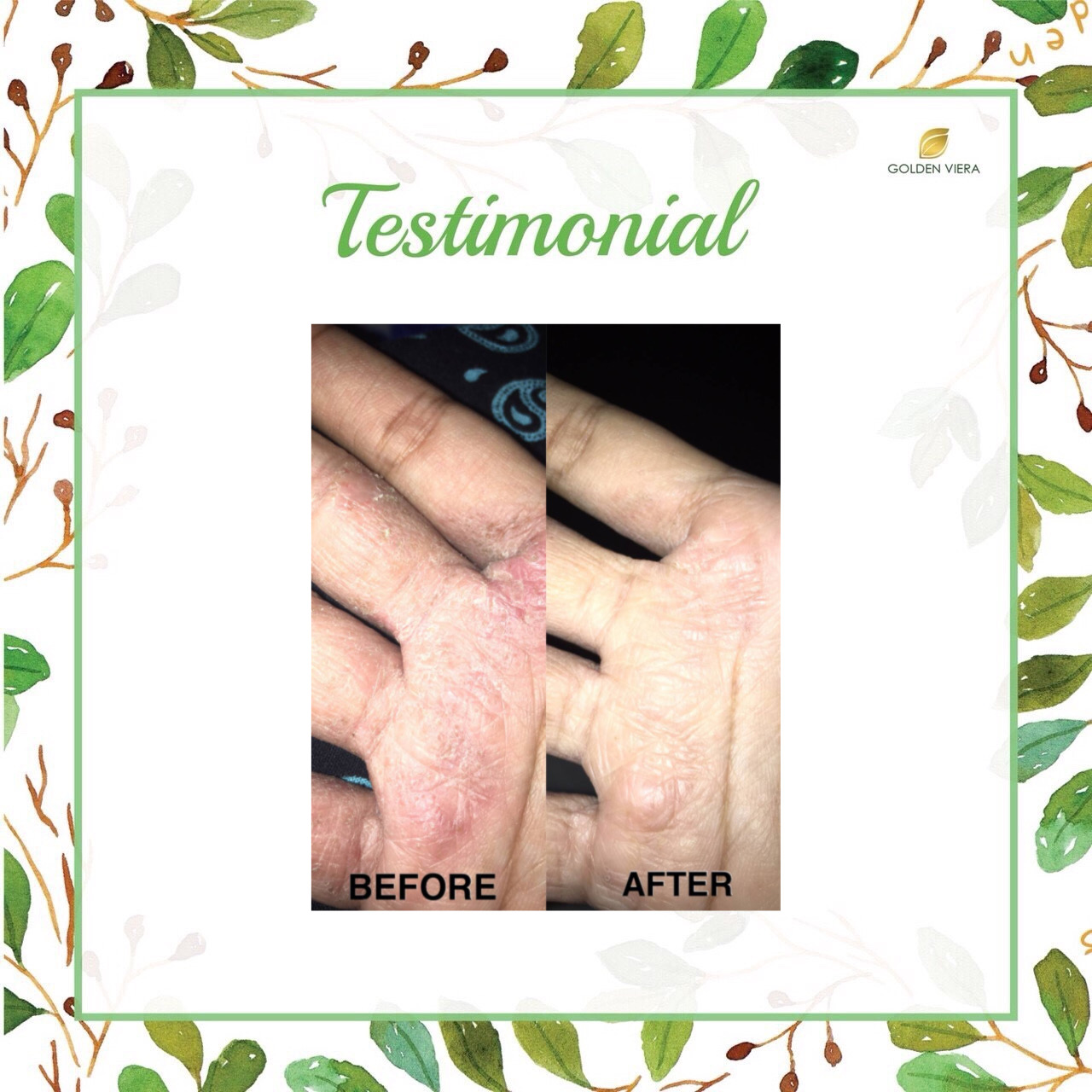 Foto testimoni S*****