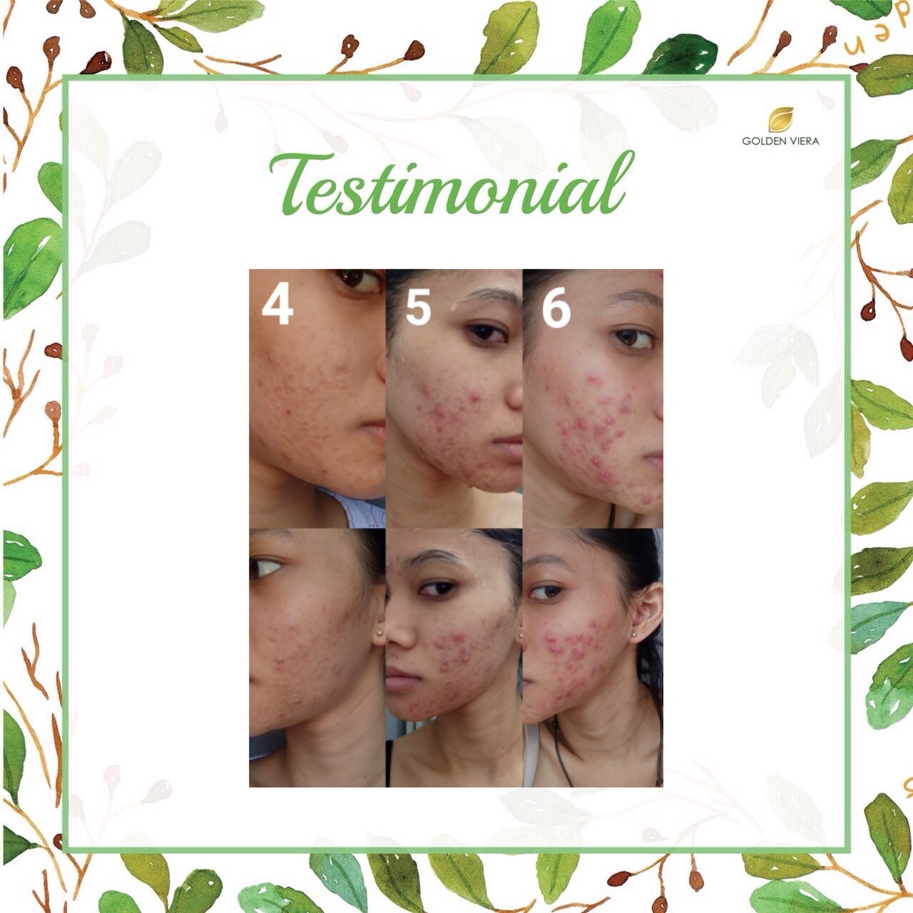 Foto testimoni A****A