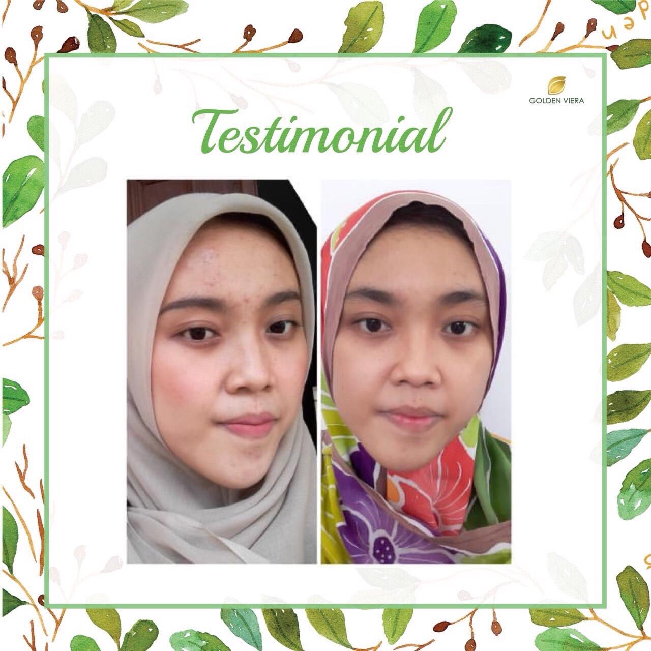 Foto testimoni N******A